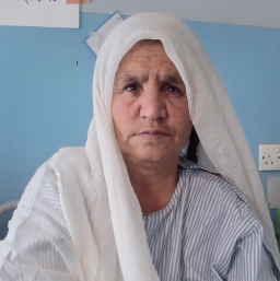 Kabuli, from Afghanistan (photo credit: CURE International)